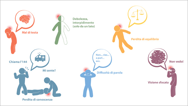 L'ictus cerebrale e i suoi sintomi